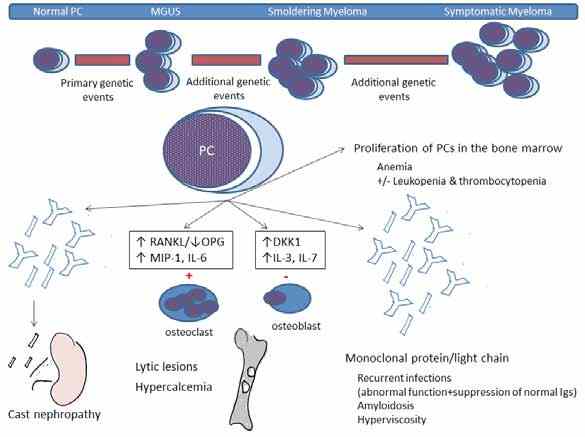 What Are Light Chains In Myeloma